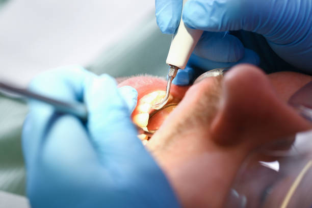 Best Emergency Denture Repair in Poseyville, IN