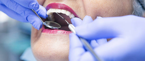 Best Emergency Tooth Extraction in Poseyville, IN